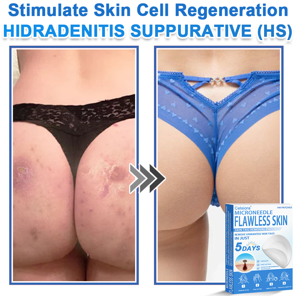 👩‍⚕️Celsiora® 2-in-1 Microneedle & Hydrocolloid Patch | Raised Moles,Acne,  Flat Warts & Skin Tags Remover | Improves Wrinkles, Blemishes & Scars | Invisible Pimple Patches for Face & Body