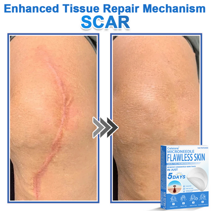 👩‍⚕️Celsiora® 2-in-1 Microneedle & Hydrocolloid Patch | Raised Moles,Acne,  Flat Warts & Skin Tags Remover | Improves Wrinkles, Blemishes & Scars | Invisible Pimple Patches for Face & Body