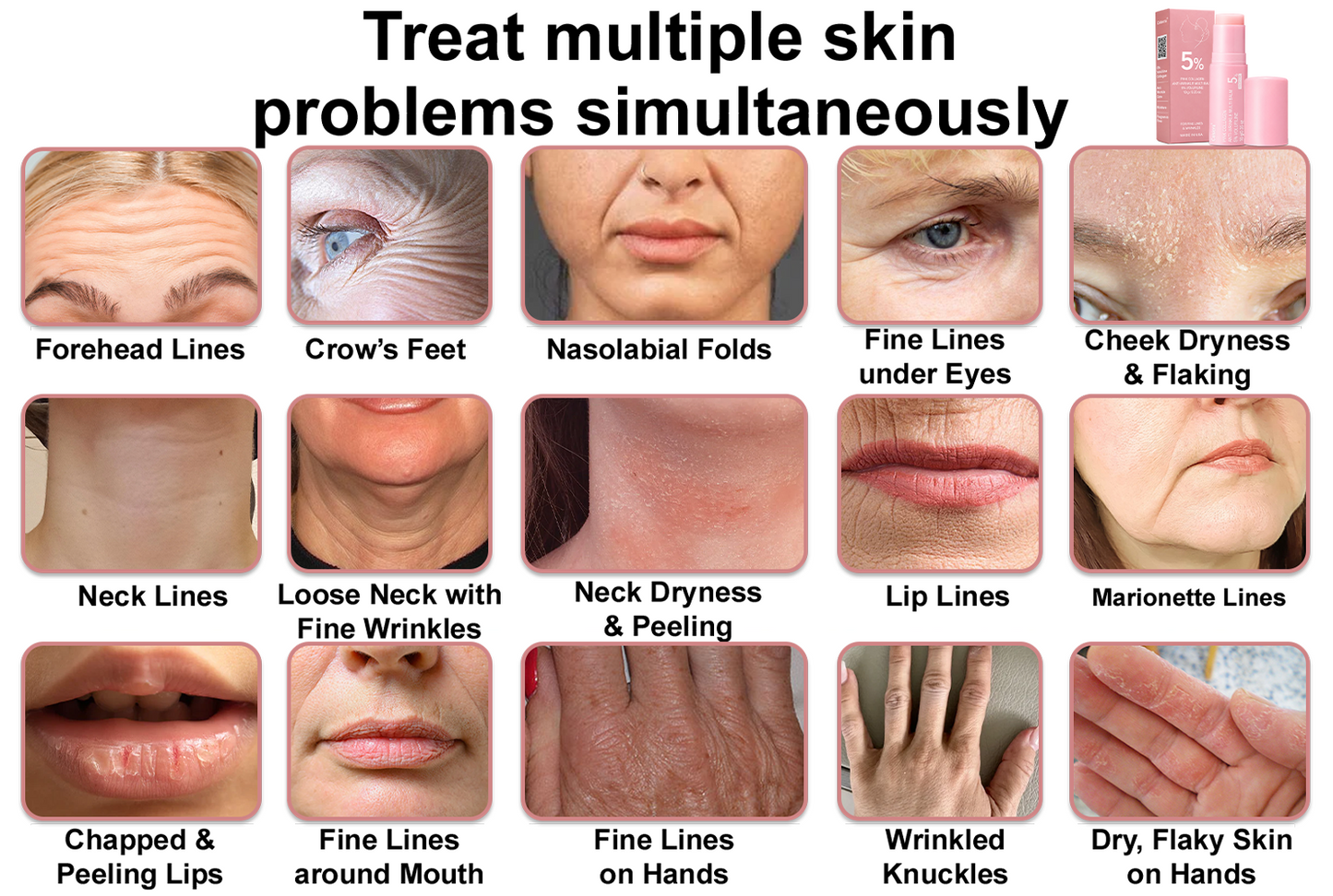 Celsiora® 💄PDRN Collagen Repair Balm (Targets wrinkles and fine lines, smooths nasolabial folds and neck wrinkles, reduces frown lines and crow's feet)