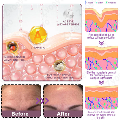Celsiora® 💄PDRN Collagen Repair Balm (Targets wrinkles and fine lines, smooths nasolabial folds and neck wrinkles, reduces frown lines and crow's feet)