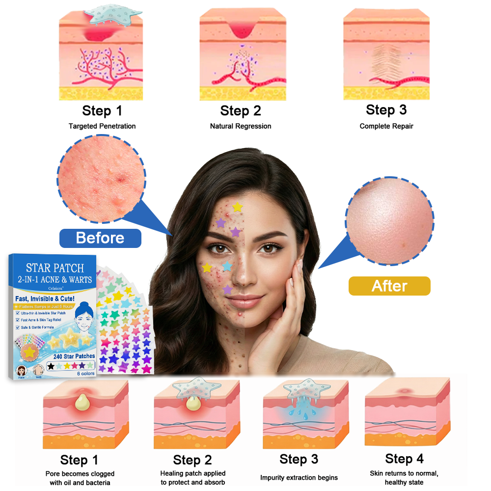 🌟Celsiora® 2-in-1 Microneedle & Hydrocolloid Star Patch | Flat Warts & Skin Tags Remover Acne, Raised Moles | 6 Colors Pimple Patch for Face & Neck | Invisible Star Zit Stickers | 240 Count 🌟