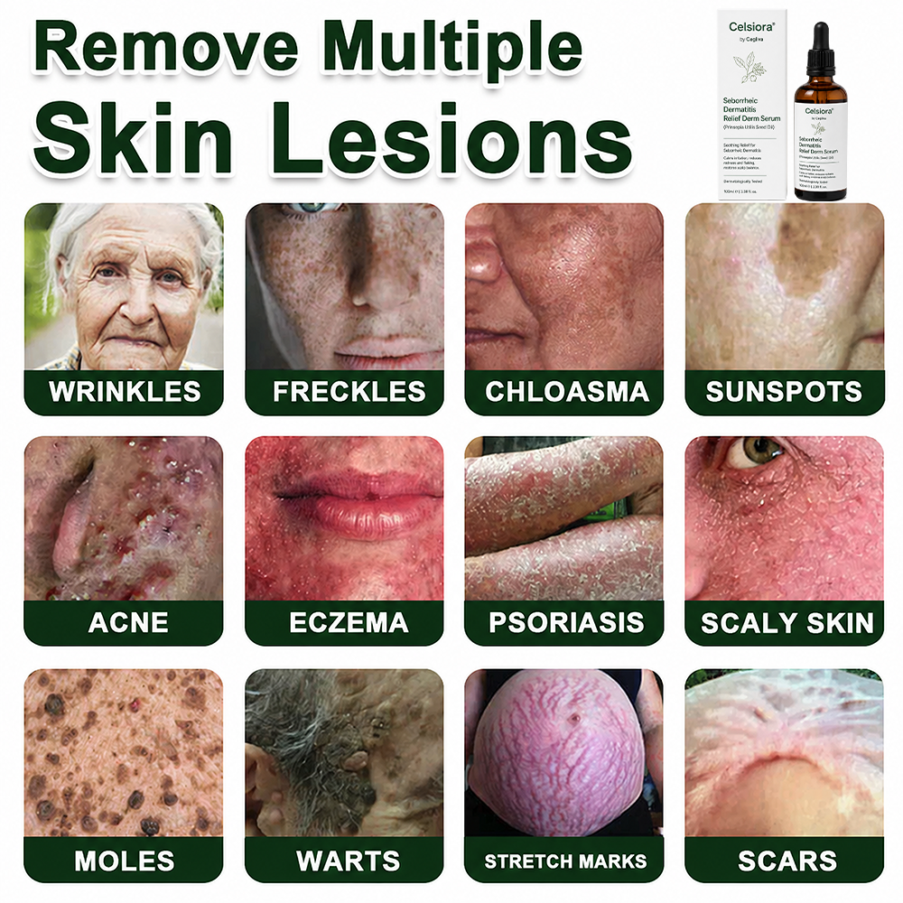 Celsiora® Seborrheic Dermatitis Relief Derm Serum
