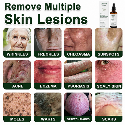 Celsiora® Seborrheic Dermatitis Relief Derm Serum