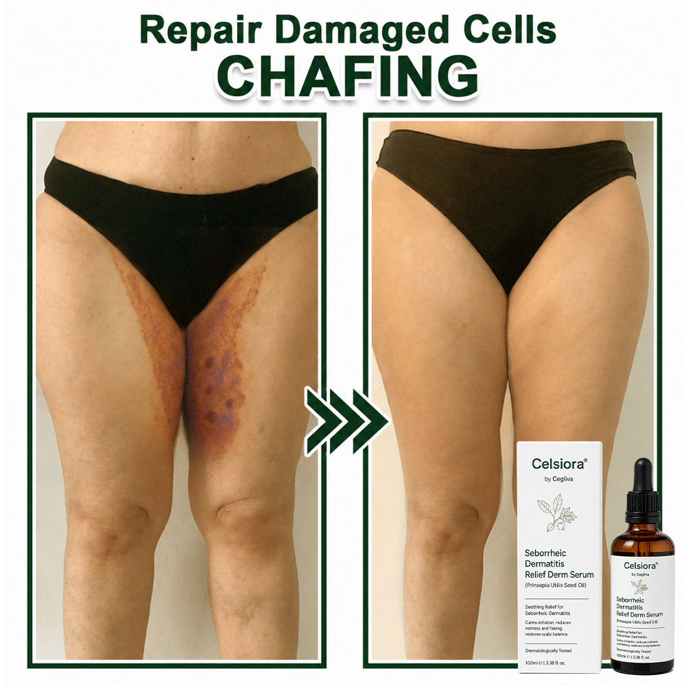 Celsiora® Seborrheic Dermatitis Relief Derm Serum