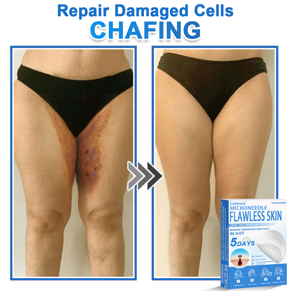 👩‍⚕️Celsiora® 2-in-1 Microneedle & Hydrocolloid Patch | Raised Moles,Acne,  Flat Warts & Skin Tags Remover | Improves Wrinkles, Blemishes & Scars | Invisible Pimple Patches for Face & Body