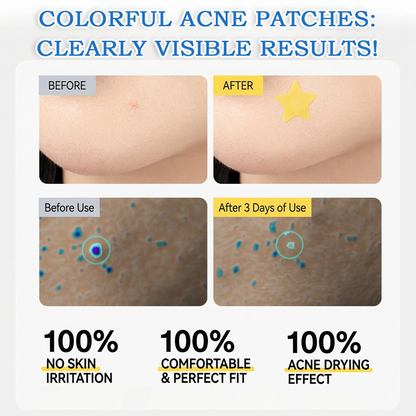 🌟Celsiora® 2-in-1 Microneedle & Hydrocolloid Star Patch | Flat Warts & Skin Tags Remover Acne, Raised Moles | 6 Colors Pimple Patch for Face & Neck | Invisible Star Zit Stickers | 240 Count 🌟