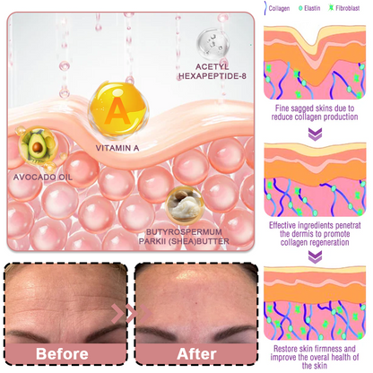 🥳60% OFF | Today Only！🥳💕PDRN Pink Collagen Volume Multi Balm | All In One Volufiline, PDRN, NAD Stick for Youthful-Looking
