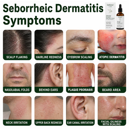 💚Celsiora® Seborrheic Dermatitis Relief Derm Serum