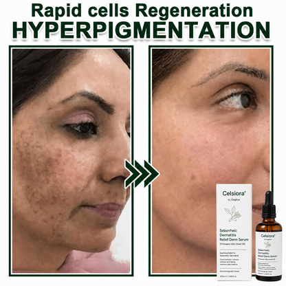 Celsiora® Seborrheic Dermatitis Relief Derm Serum