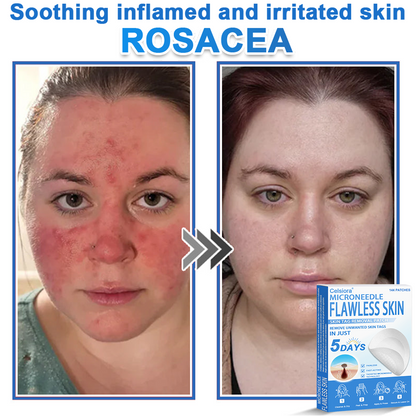 👩‍⚕️Celsiora® 2-in-1 Microneedle & Hydrocolloid Patch | Raised Moles,Acne,  Flat Warts & Skin Tags Remover | Improves Wrinkles, Blemishes & Scars | Invisible Pimple Patches for Face & Body