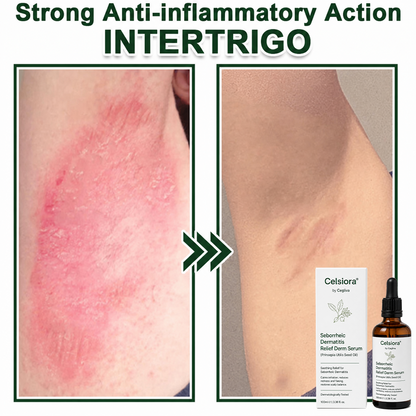 Celsiora® Seborrheic Dermatitis Relief Derm Serum