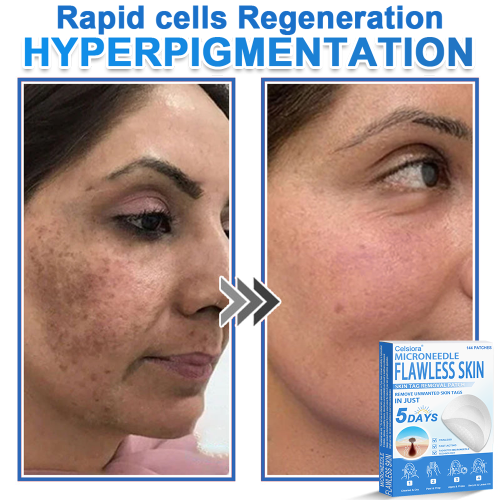 👩‍⚕️Celsiora® 2-in-1 Microneedle & Hydrocolloid Patch | Raised Moles,Acne,  Flat Warts & Skin Tags Remover | Improves Wrinkles, Blemishes & Scars | Invisible Pimple Patches for Face & Body