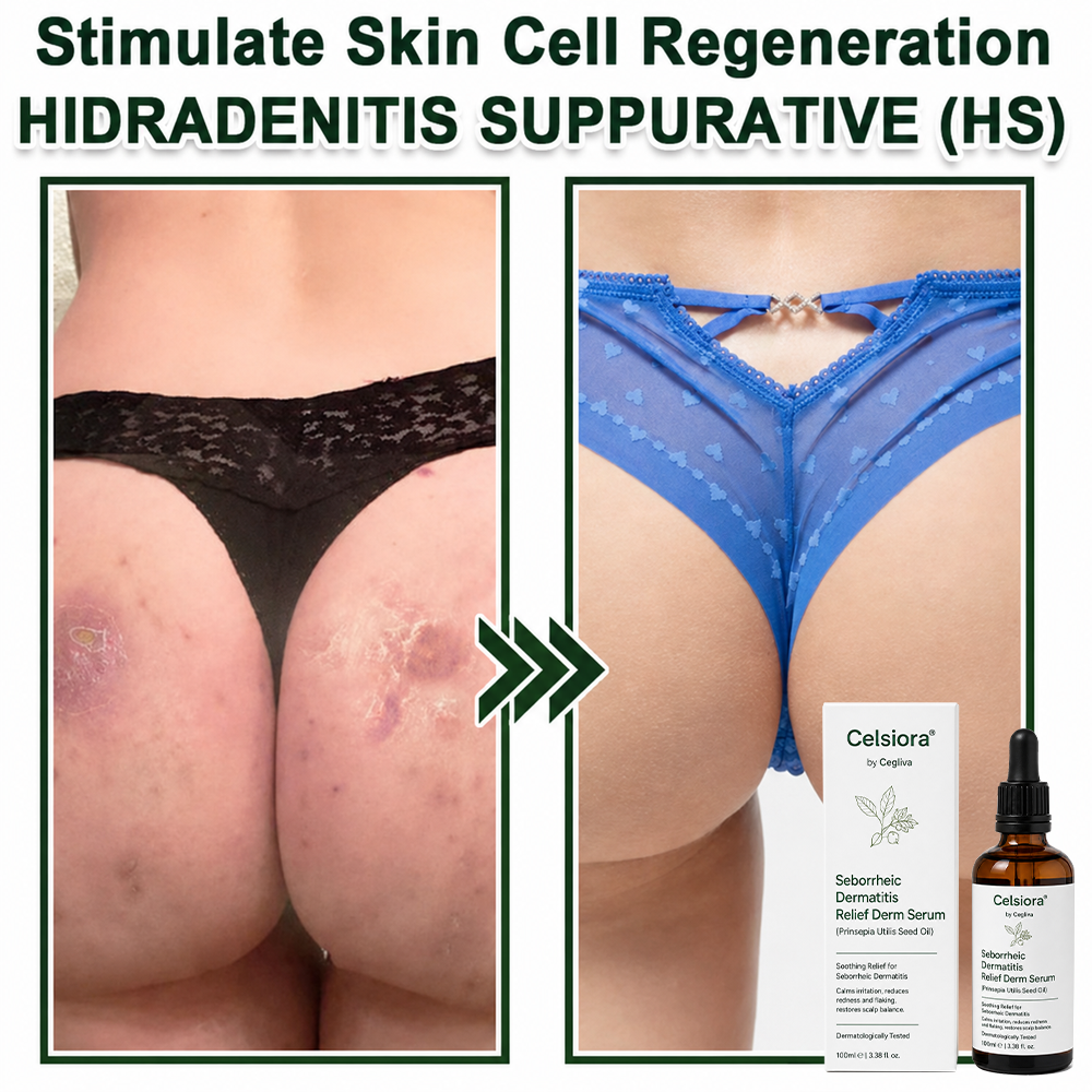 Celsiora® Seborrheic Dermatitis Relief Derm Serum