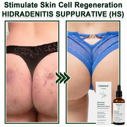 Celsiora® Seborrheic Dermatitis Relief Derm Serum