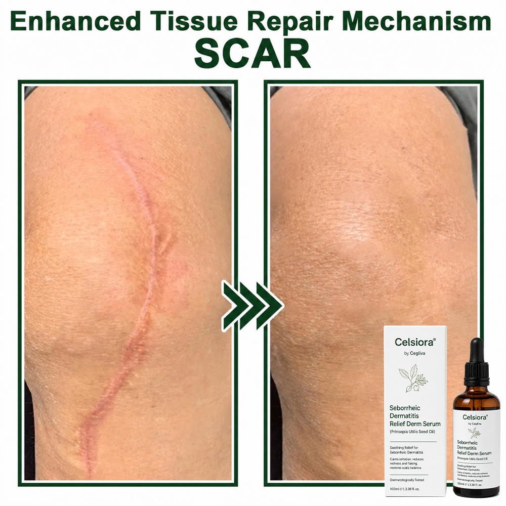 Celsiora® Seborrheic Dermatitis Relief Derm Serum
