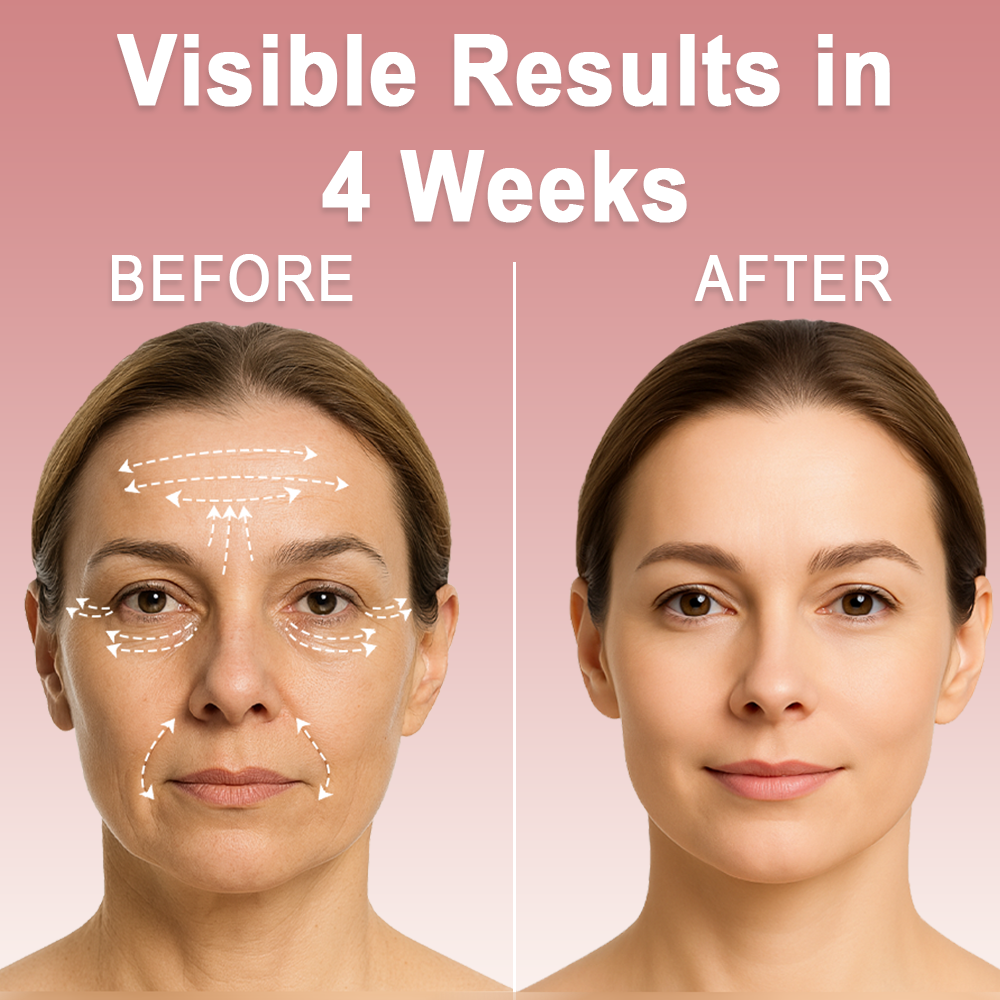 Celsiora® 💄PDRN Collagen Repair Balm (Targets wrinkles and fine lines, smooths nasolabial folds and neck wrinkles, reduces frown lines and crow's feet)